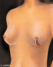 plastic surgery virginia washington dc maryland