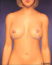 plastic surgeon washington dc maryland virginia